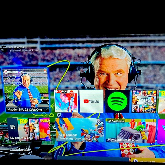 Xbox 1s